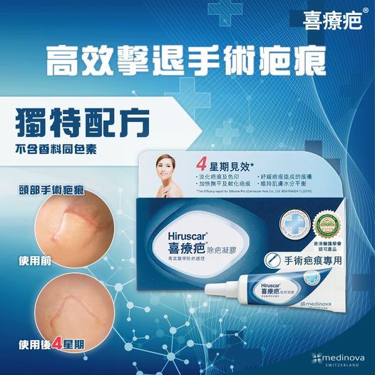 喜療疤 - 喜療疤 除疤凝膠 10g