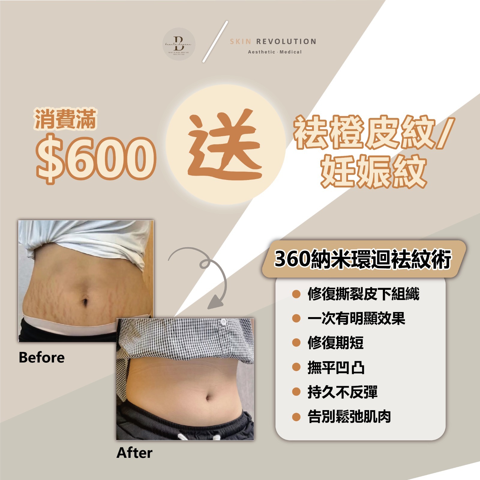 購買任何產品滿$600 送祛橙皮紋/妊娠紋