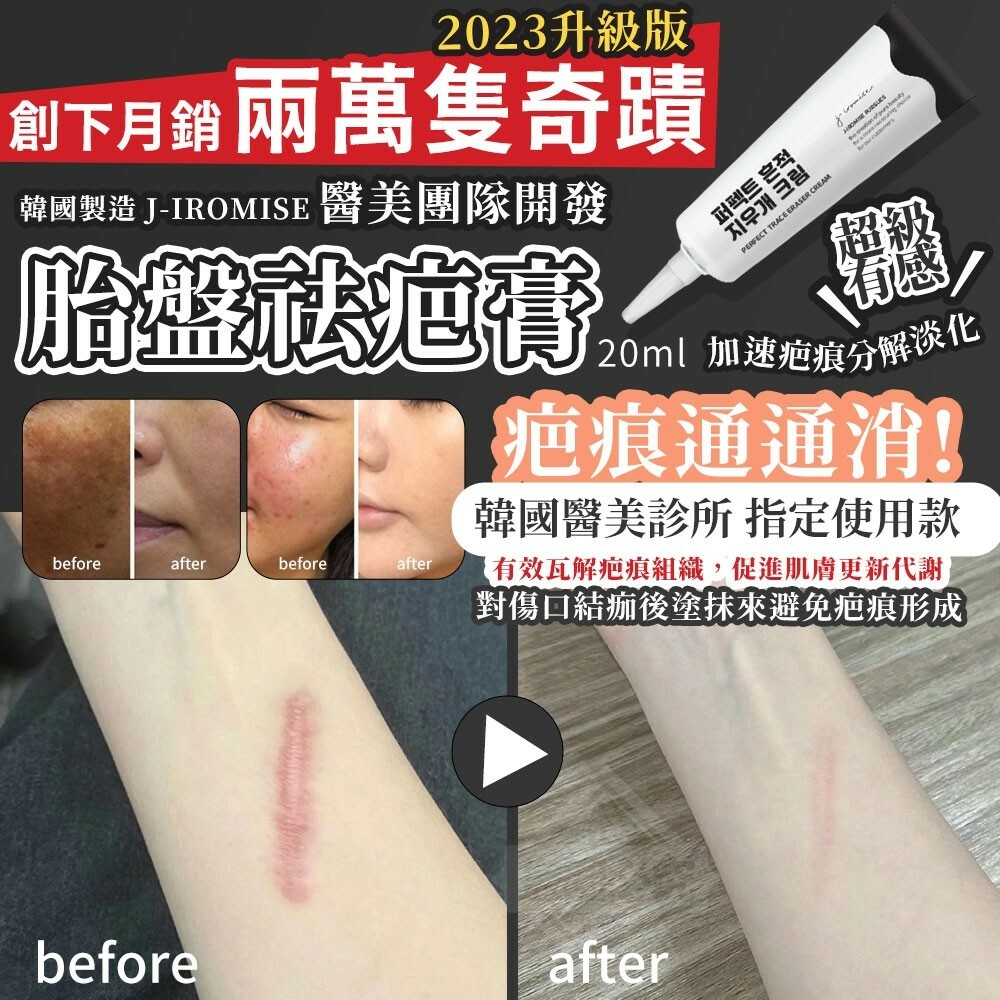 韓國製造J-IROMISE醫美團隊開發胎盤祛疤膏20ml