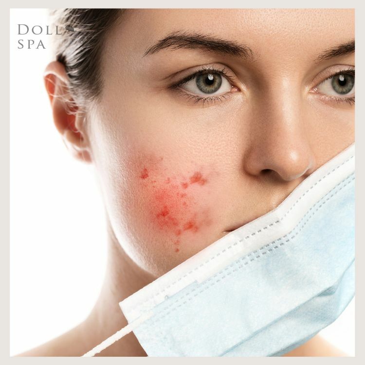 長時間戴口罩皮膚出油、長粉刺