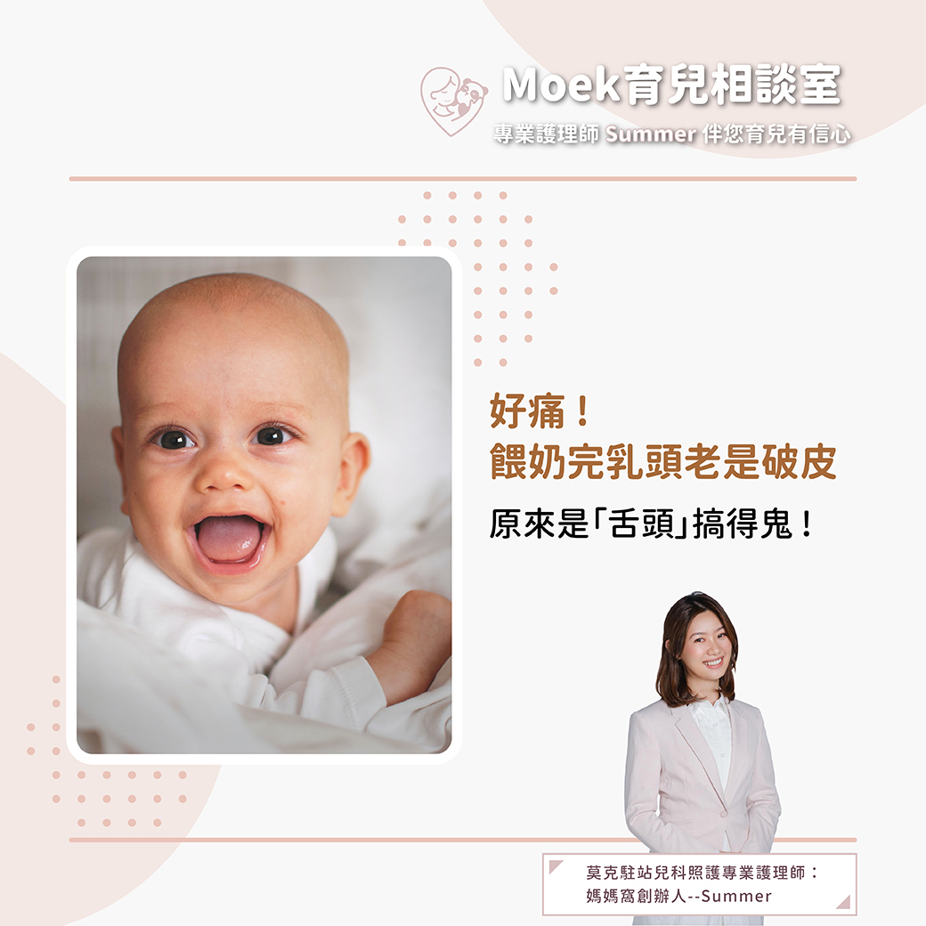 莫克,moek,嬰兒,育兒,舌頭,舌繫帶,餵奶