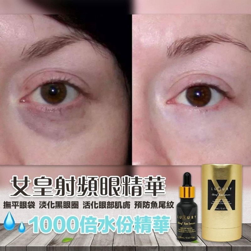 Luxury 明眸奇蹟射頻眼