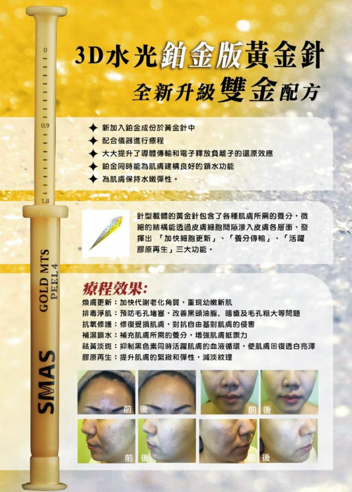 SMAS-第四代鉑金版 3D水光納米黃金針療程 1盒做20次★
