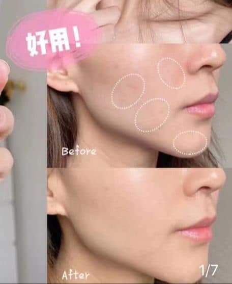 🌈Clinique 鐳射勻淨科研亮白淡斑雙效精華100ml✨