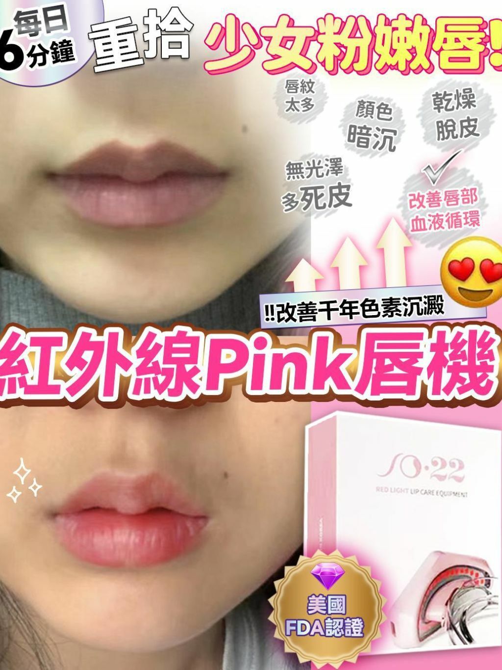 紅外線pink 唇機