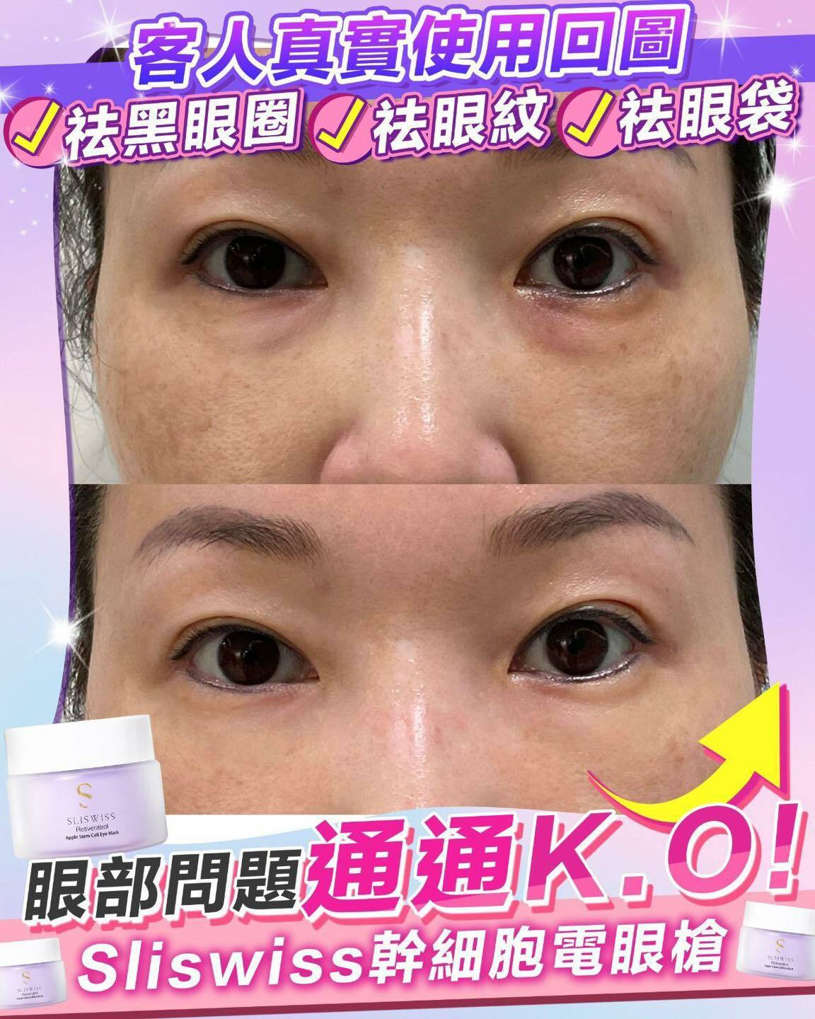 Sliswiss 白藜蘆醇幹細胞HIFU電眼槍 25g