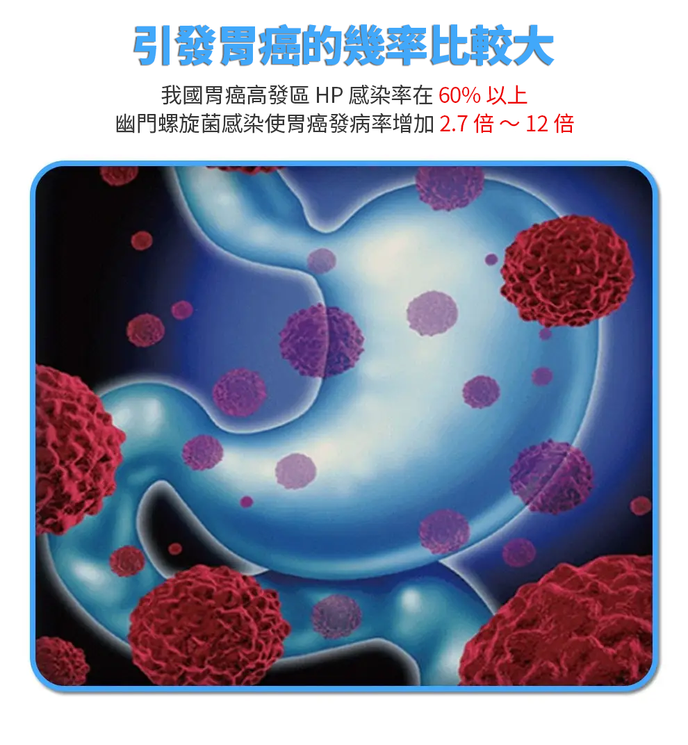 【 Spruce Nutrition 】10 + 12 配方 強效綜合益生菌｜Digestive Health｜14 包裝（美國原裝行貨）