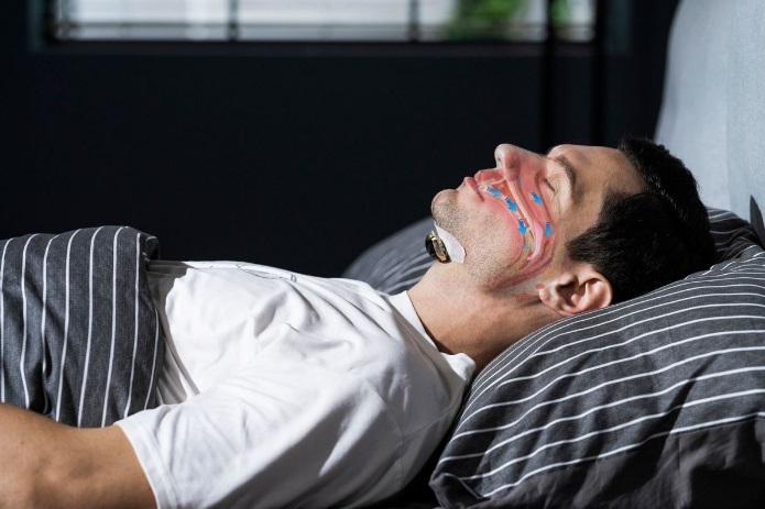 Sleepmi Z3 第三代 睡眠偵測EMS止鼻鼾器