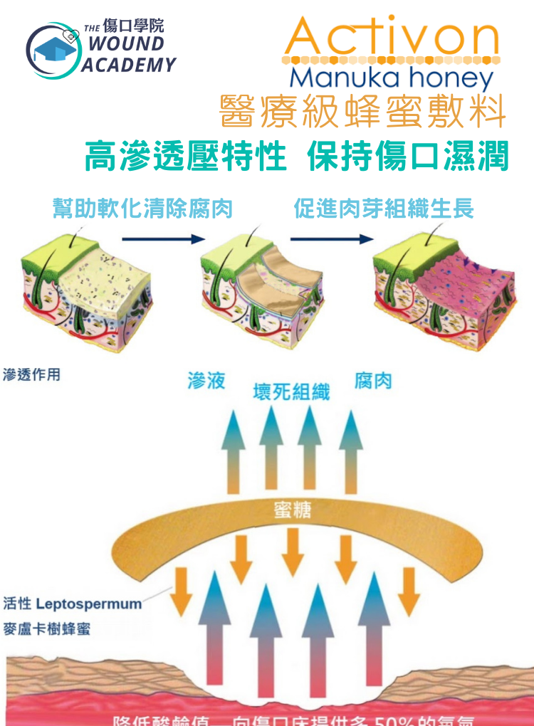 醫療級麥蘆卡清創蜂蜜 Activon Tube Manuka Honey