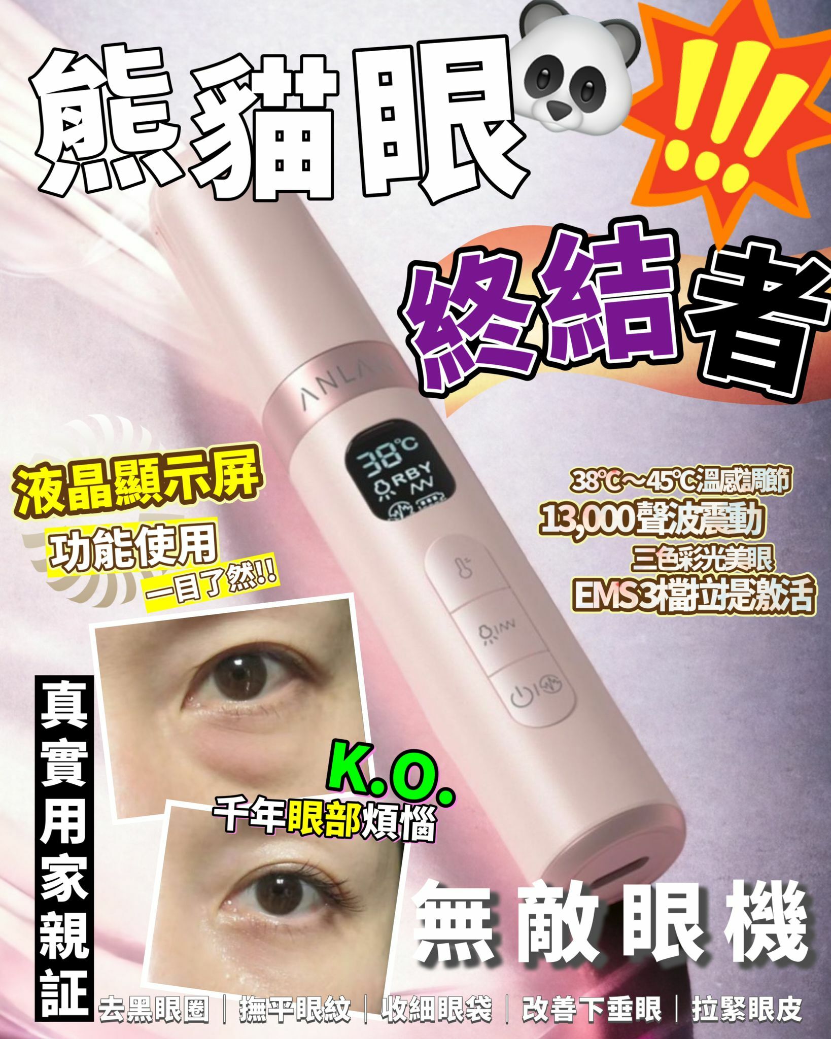 ANLAN 無敵眼機 粉/白(2色選)