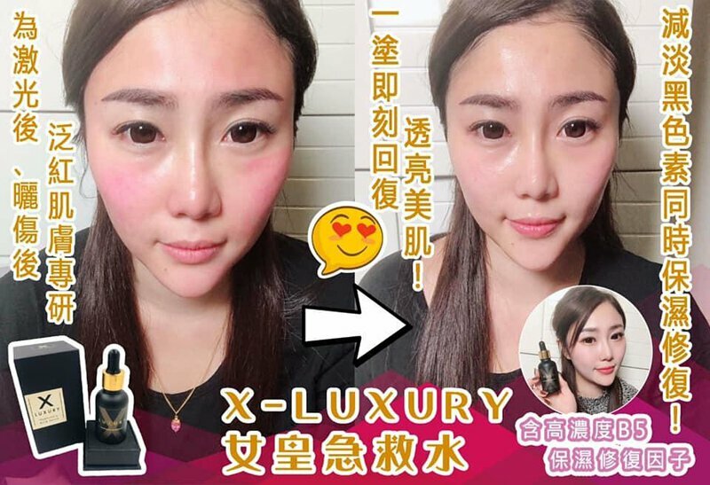 Luxury 女皇急救水 30ML