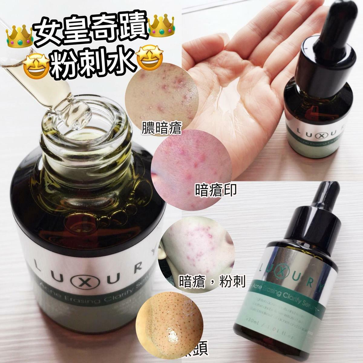 🔥Luxury 女皇奇蹟粉刺水 30ML
