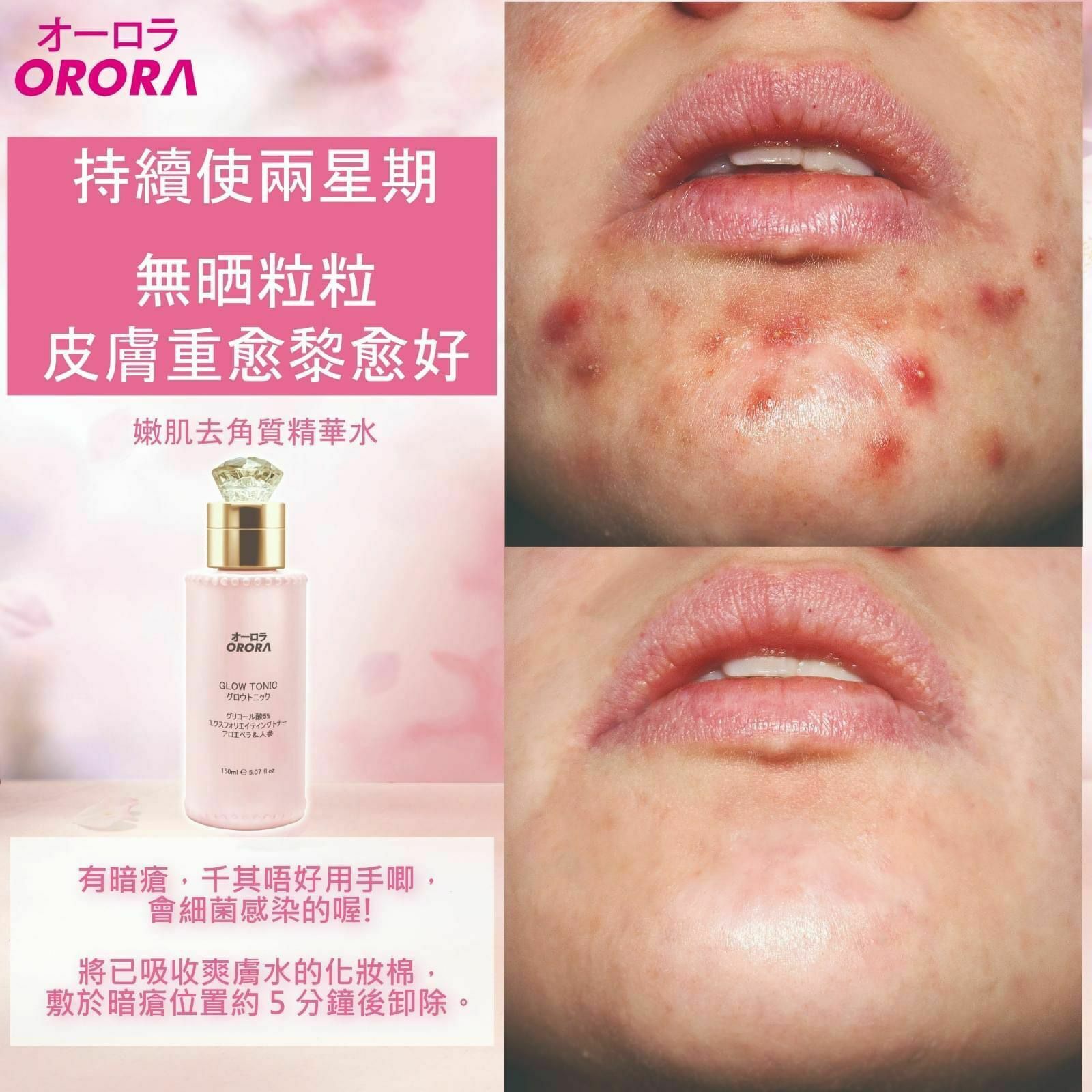日本 ORORA 神仙嫩肌去角質爽膚水 150ml