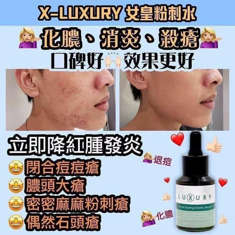 Luxury 女皇奇蹟粉刺水 30ml