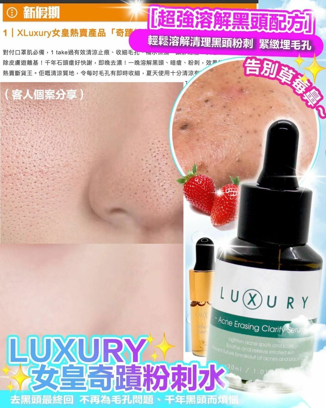 X-Luxury 女皇奇蹟粉刺水 30ml [#SQ24032902]