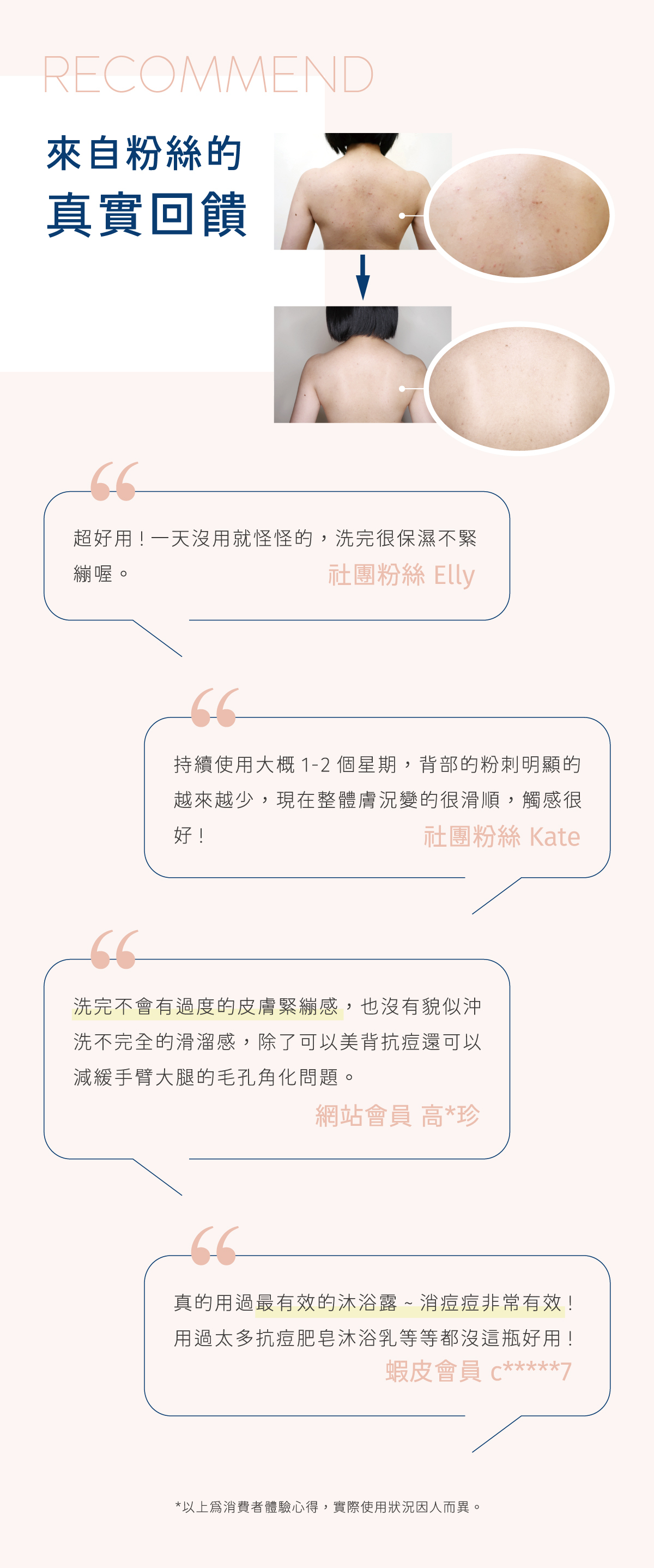 網友大推，抗痘最有感的沐浴露