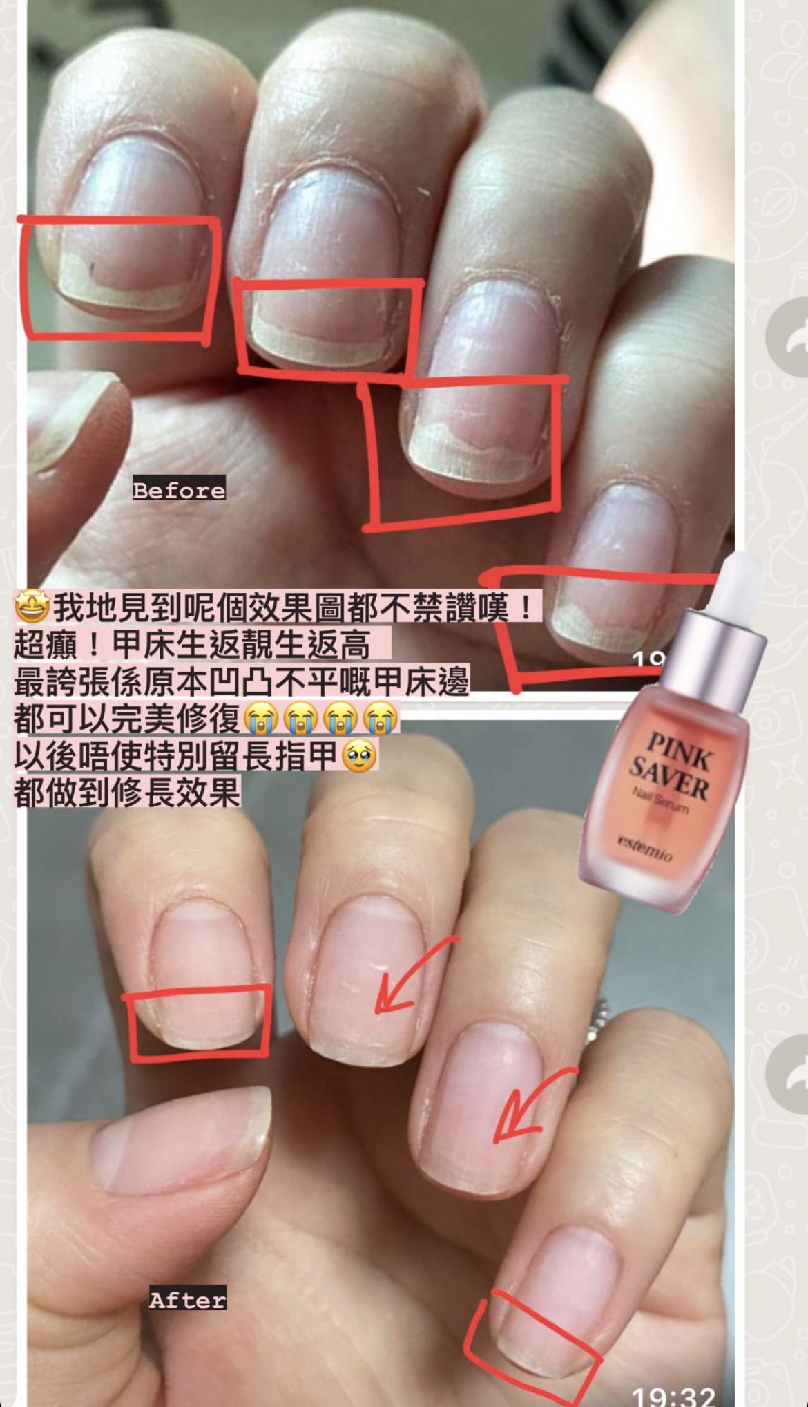 王牌產品 Deluxe一套八件