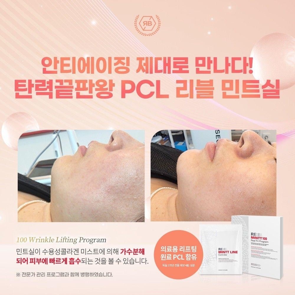 韓國RE：BL MINTT 100無針埋線面膜 🌹套裝包括：埋線面膜3片+安瓶噴霧1支+抗皺面膜3片🌹（3次裝）