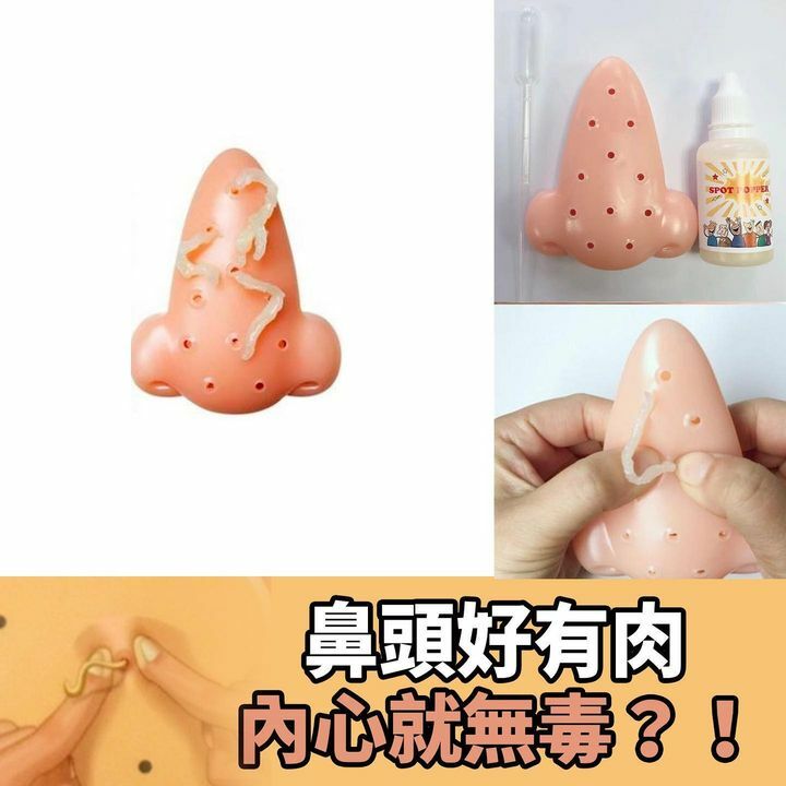 鼻大黑頭吱吱器