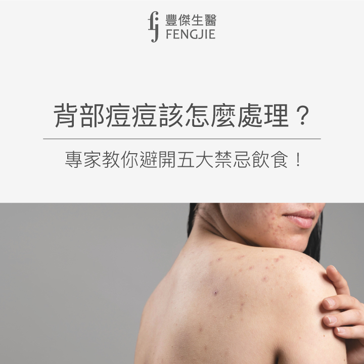 背部痘痘怎麼處理