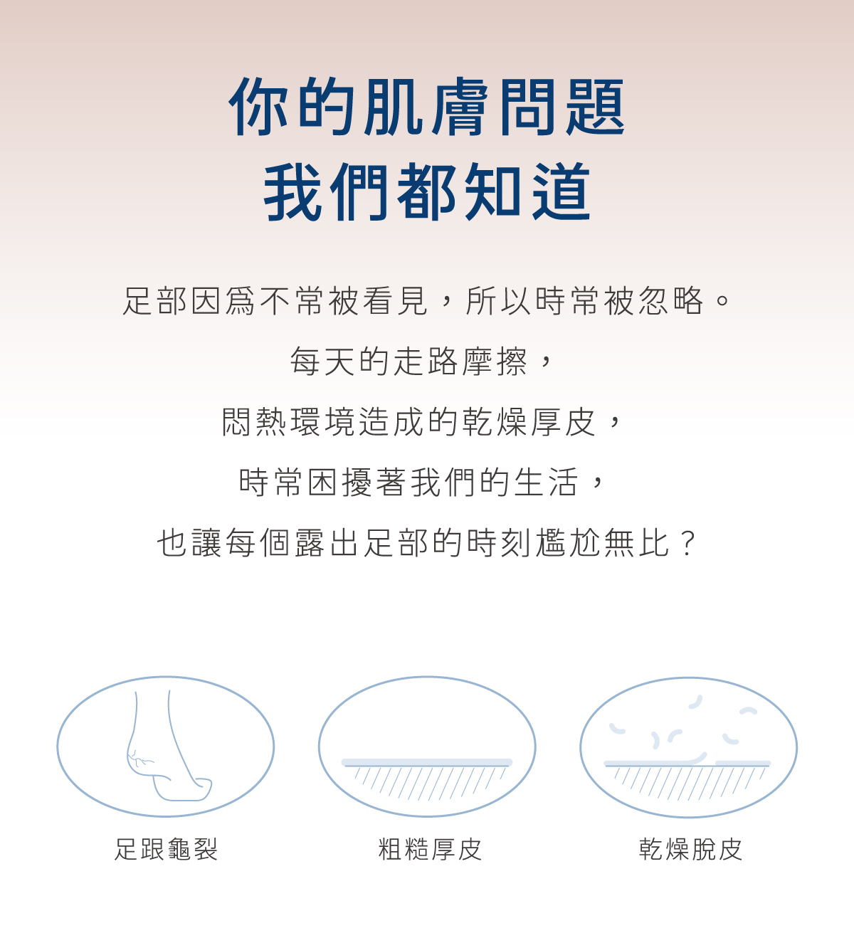 足跟龜裂、粗糙厚皮、乾燥脫皮適用