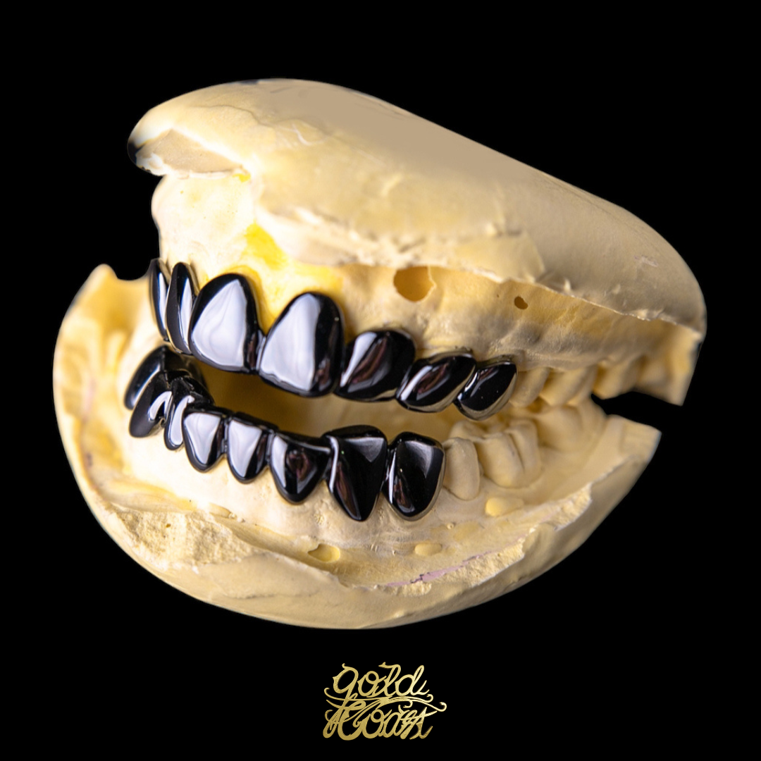 珠寶訂製光面黑色牙套