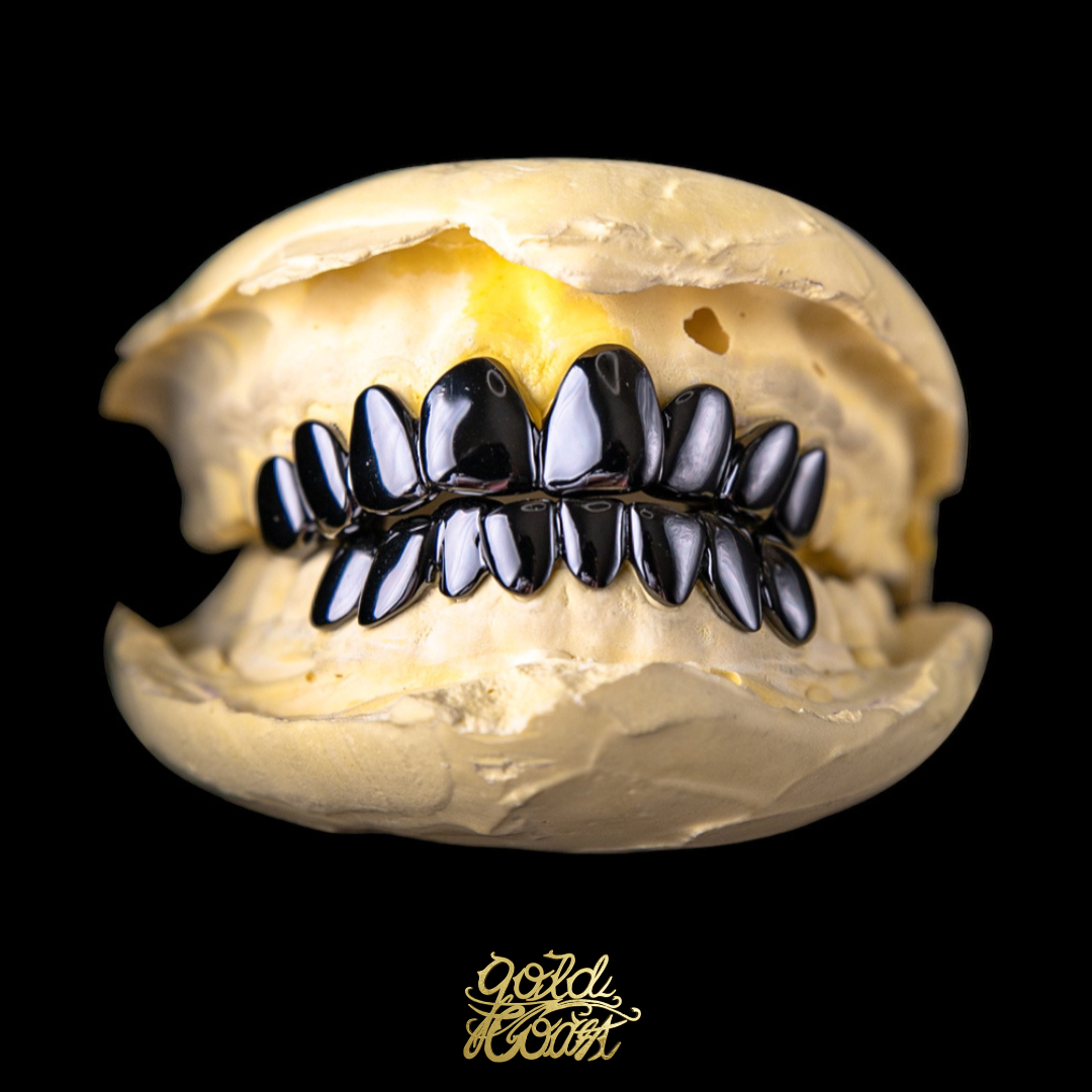 珠寶訂製光面黑色牙套