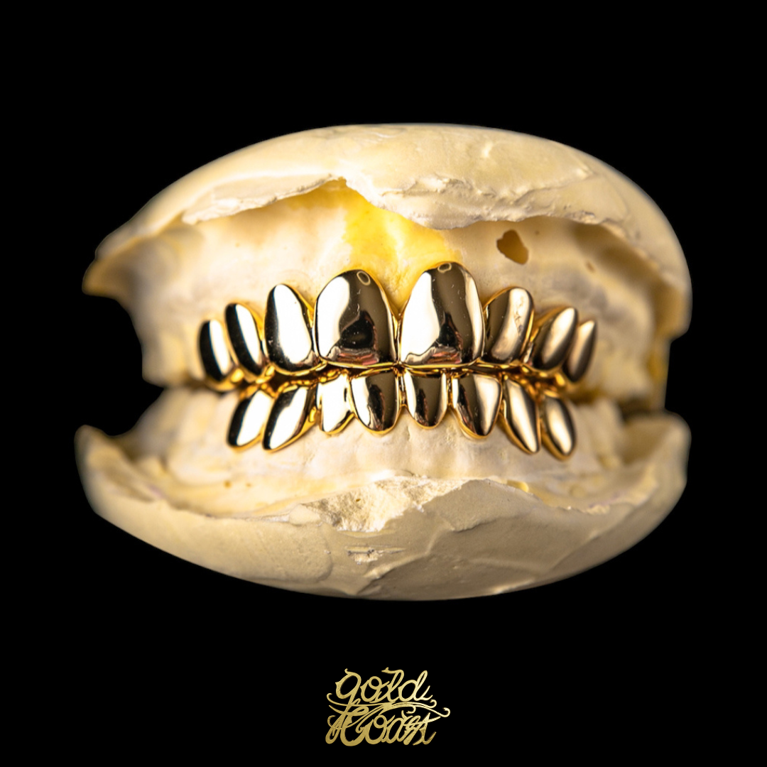 珠寶訂製光面金色牙套