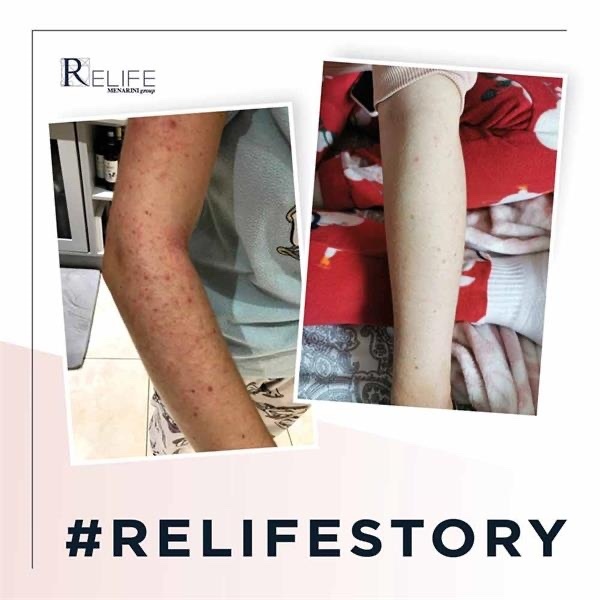 現貨供應 【香港原裝行貨】皇牌產品 樂敏膚 Relife Relizema Cream 100ml 濕疹膏 意大利製造 敏感肌救星 無類固醇 抗氧化因子潤膚膏 (專為濕疹人士而設) 到期日2027年9月