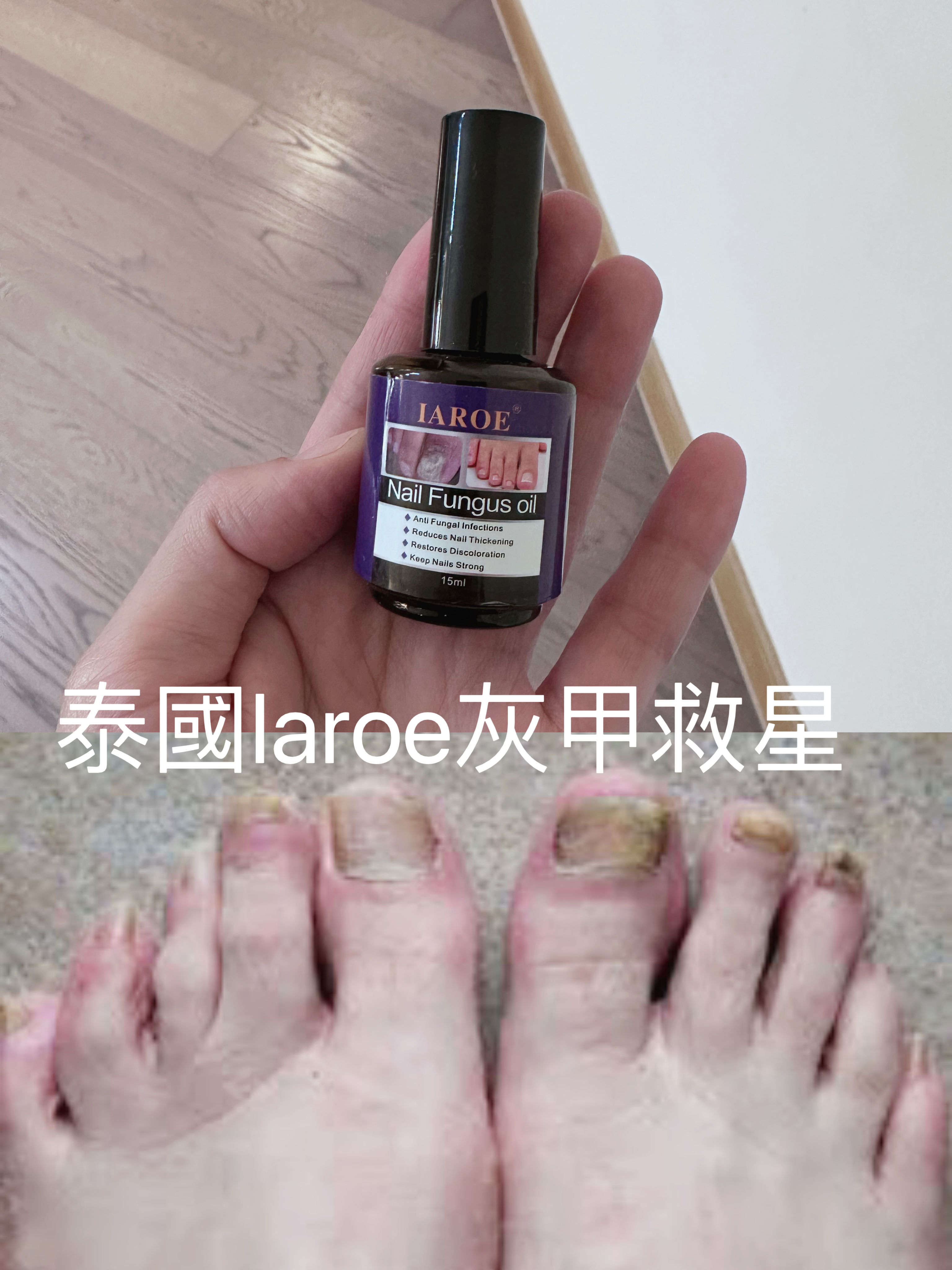 泰國IAROE強效去灰甲水15ml Y879🔥高評價熱賣