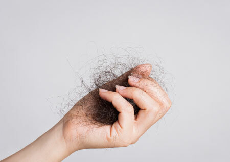 頭皮脂漏性皮膚炎，會不會造成嚴重落髮？