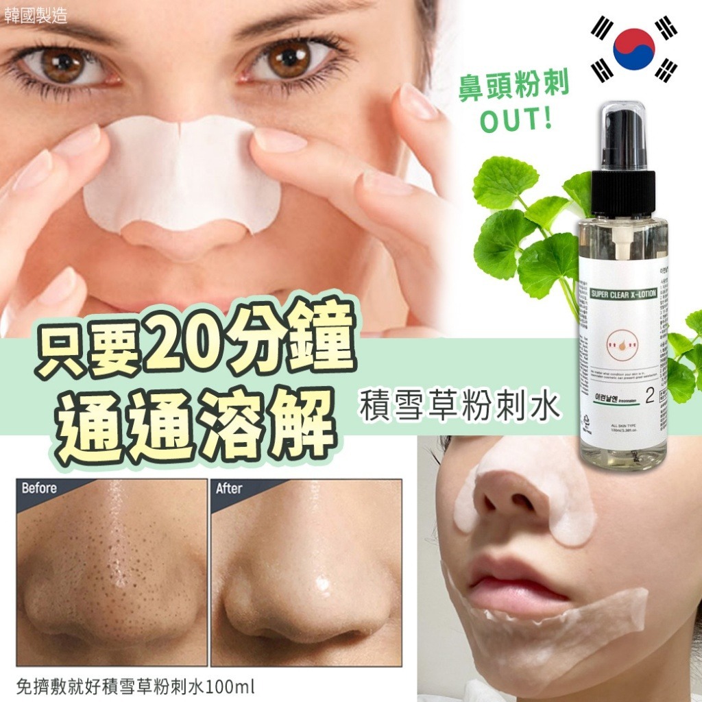 WSBB1890 韓國免擠敷就好積雪草粉刺水100ml（現貨20270212-S11）