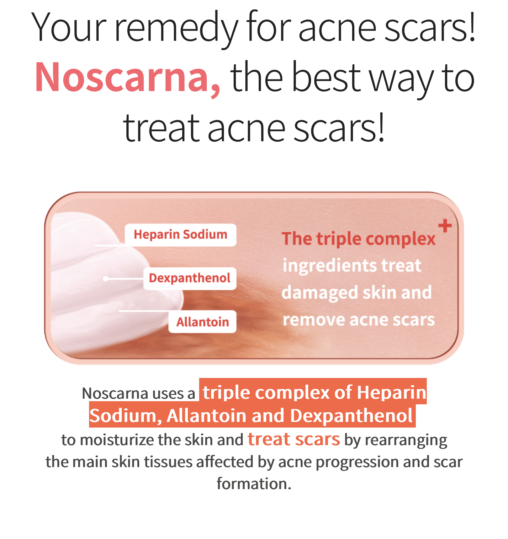 《現貨》Dong-A Pharm Noscarna Acne Scars Removal Gel Large Size 20g