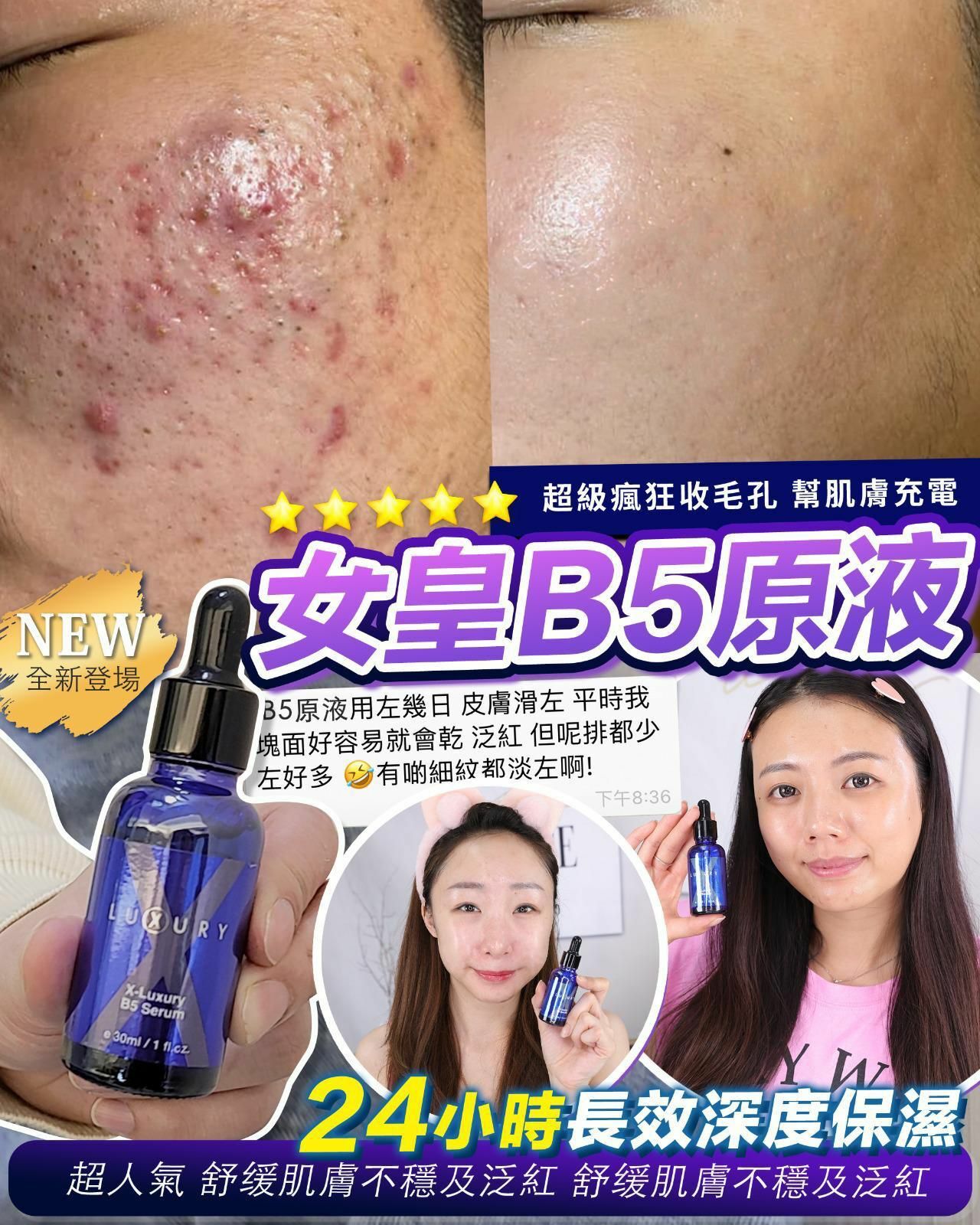 Xluxury 女皇B5泵水精華