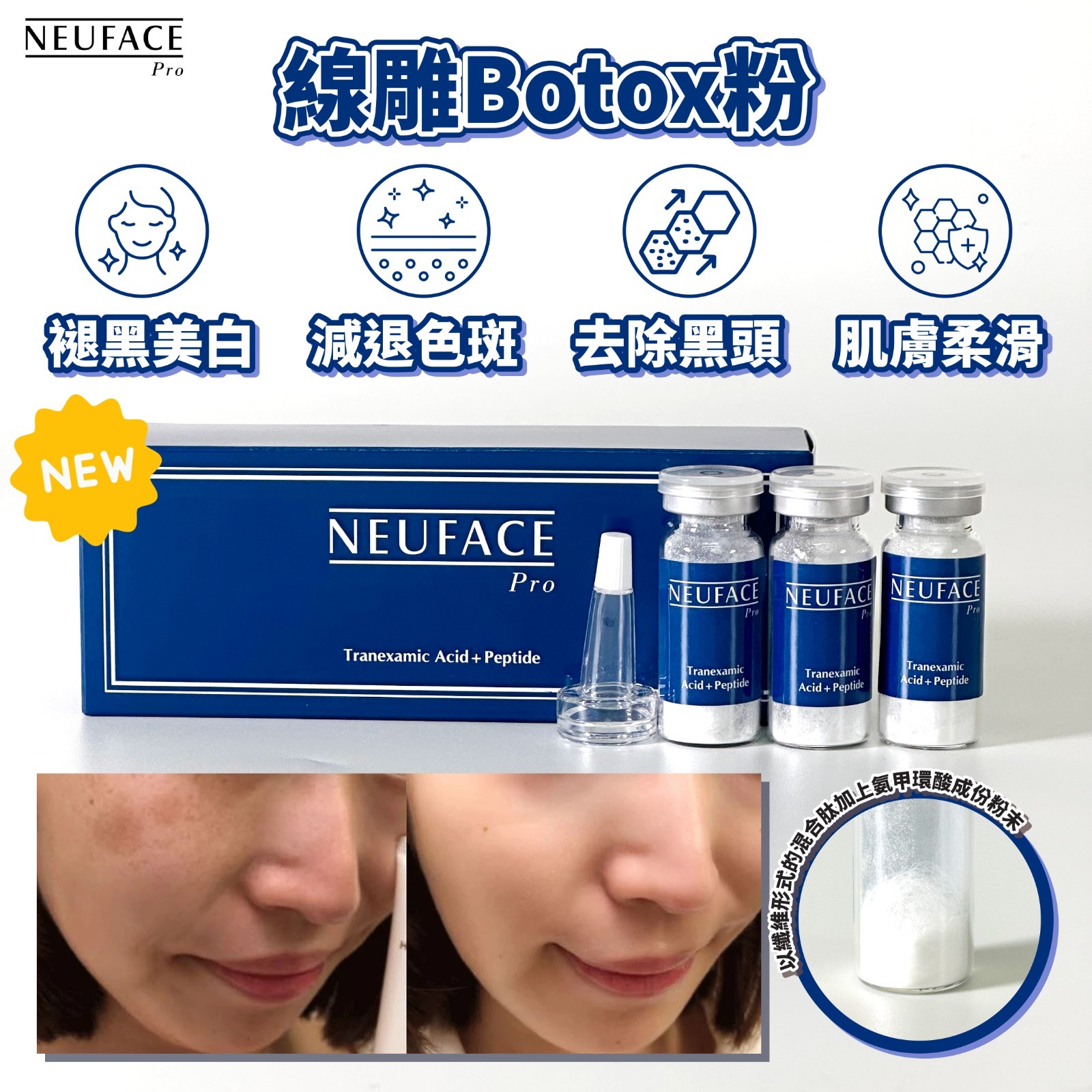 NEUFACE PRO Tranexamic Acid+ Peptide （線雕Botox粉）