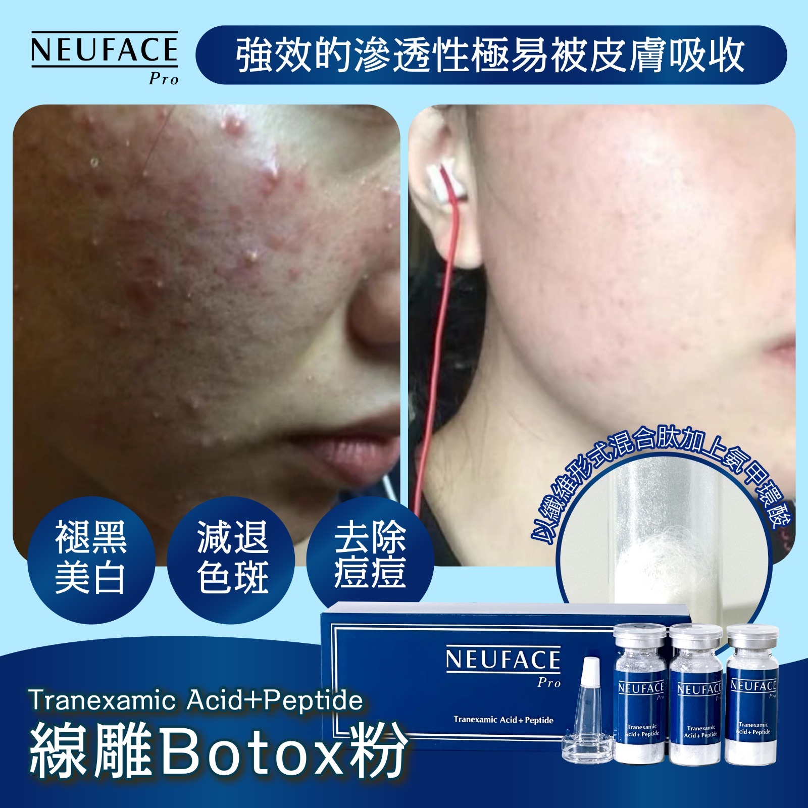 NEUFACE PRO Tranexamic Acid+ Peptide （線雕Botox粉）