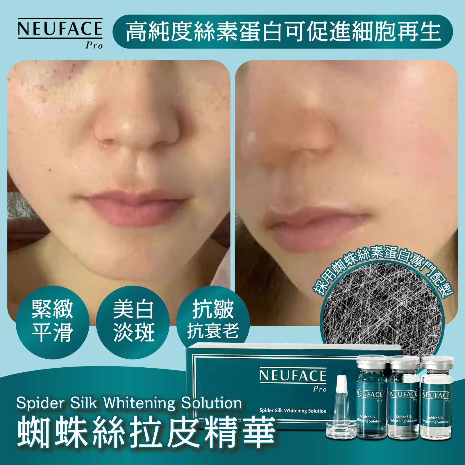 Neuface Pro Spider Silk Whitening Solution（蜘蛛絲拉皮精華）