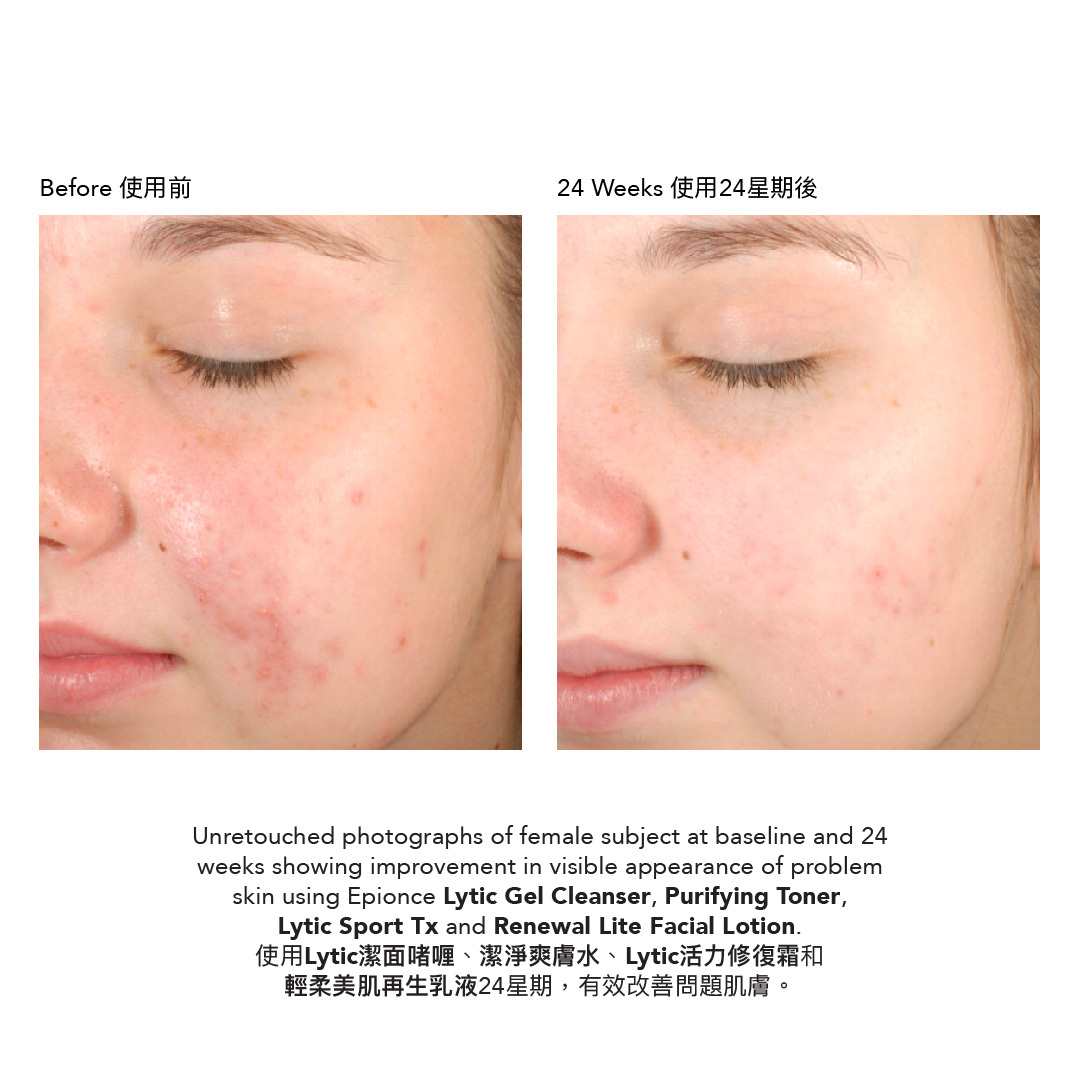 輕柔美肌再生乳液