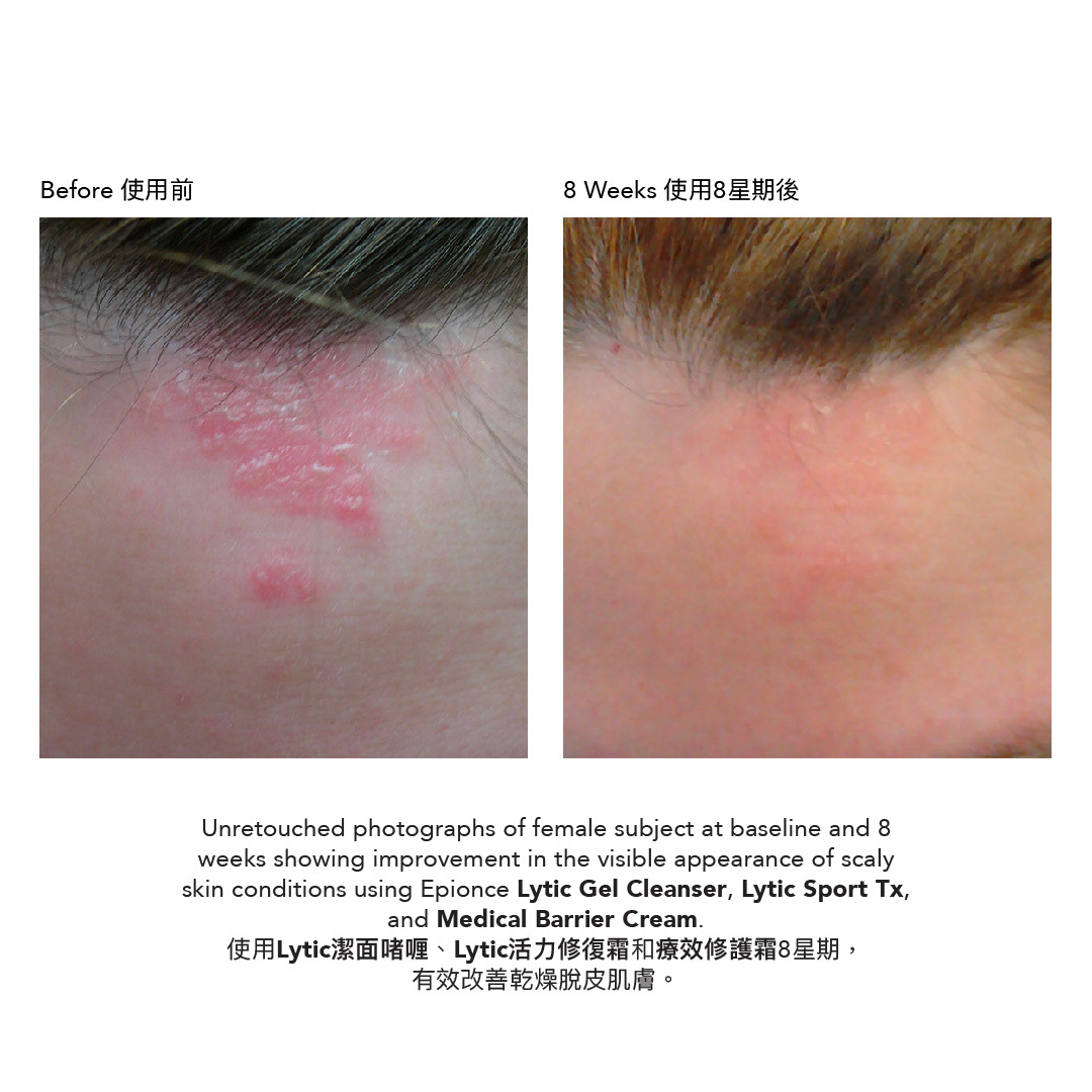 Lytic活力修復霜