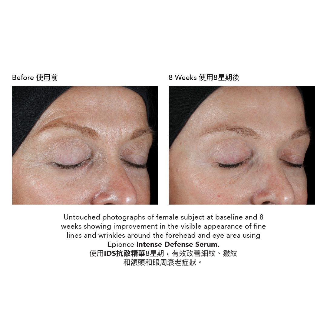 IDS抗敵精華