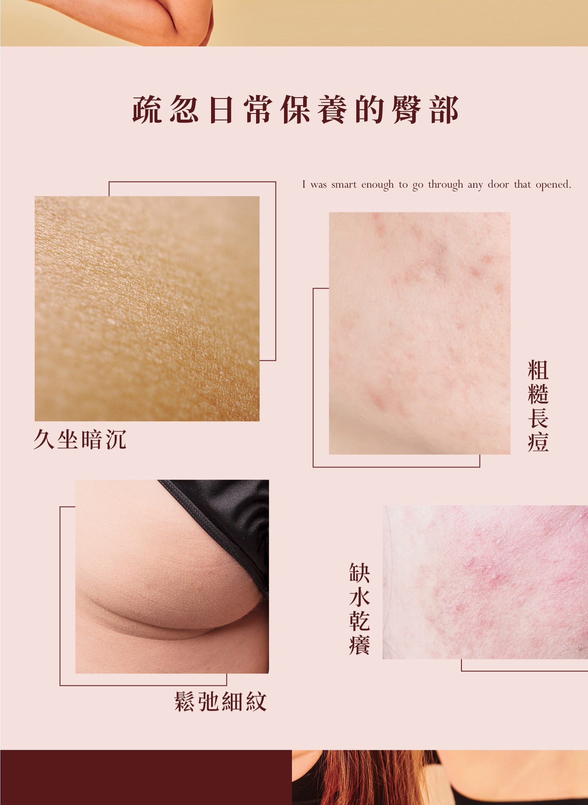 Peachup,臀膜,屁股長痘痘,私密處保養,屁股暗沈