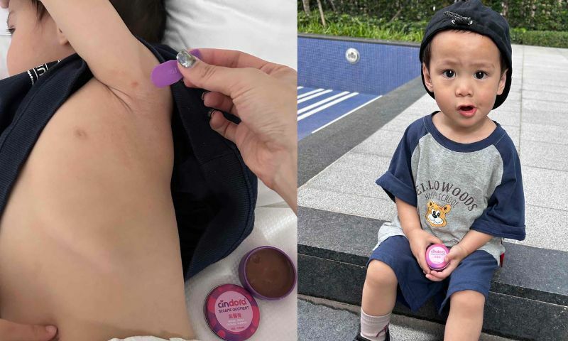 【紫馨膏】來跟️小宇宙一起用紫馨膏保護肌膚健康吧！