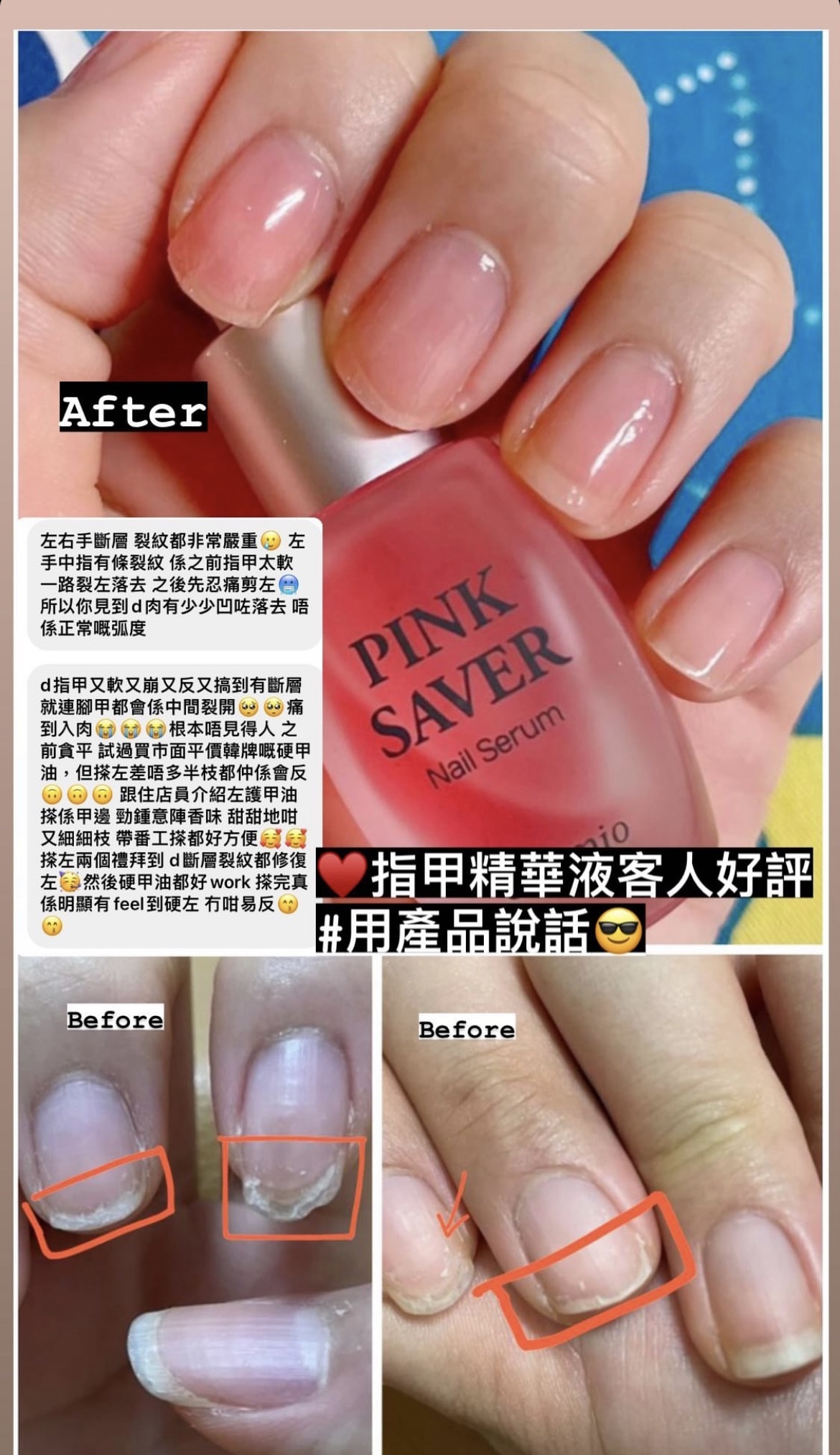 3支 王牌產品⭐️指甲精華液