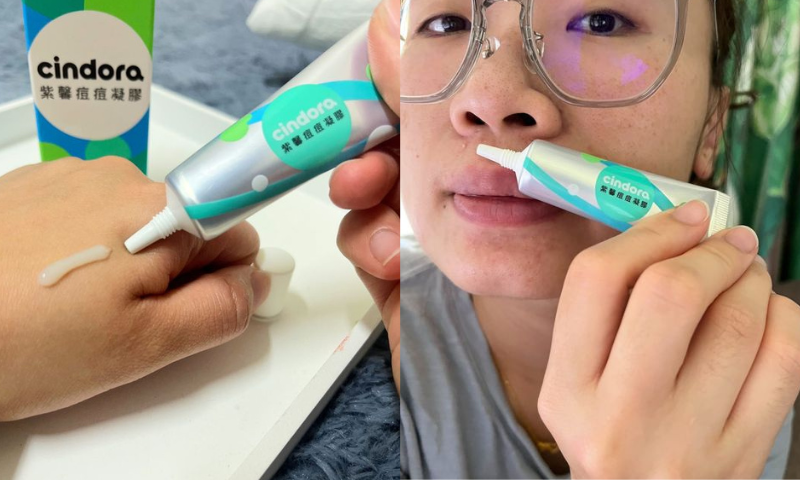【紫馨撫平痘痘凝膠】樂樂＆欣欣媽推薦，媽咪孕期抗痘痘必備好物！