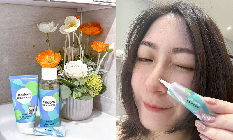 【紫馨撫平痘痘系列】莊兔子推薦，媽咪孕期抗痘痘必備好物！