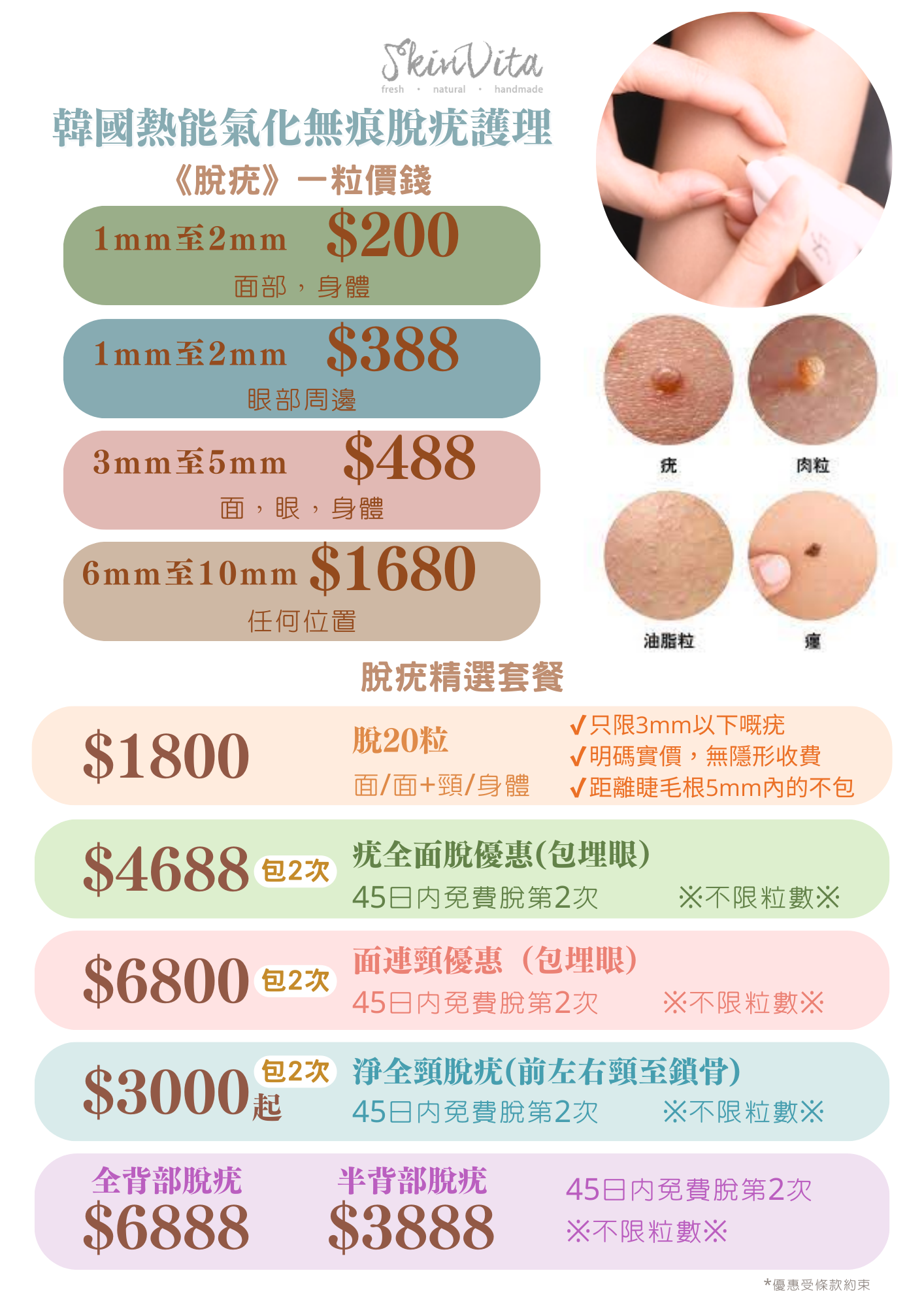 韓國熱能氣化無痕脫疣護理