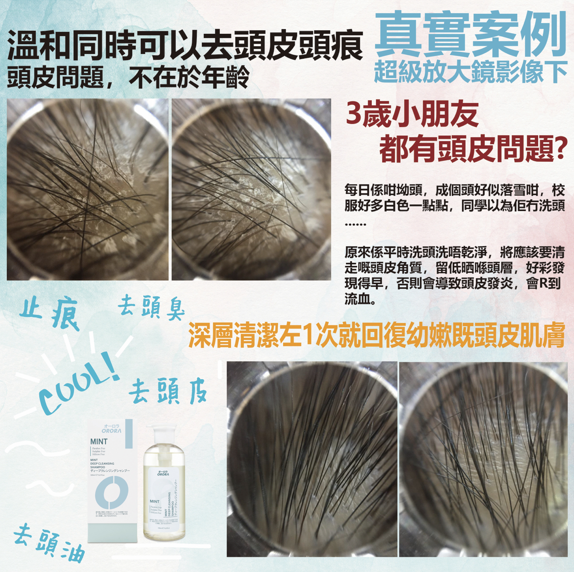 日本🇯🇵Orora天然香系列- 薄荷深層清潔洗髮乳 (頭皮污垢擦子膠)500ml