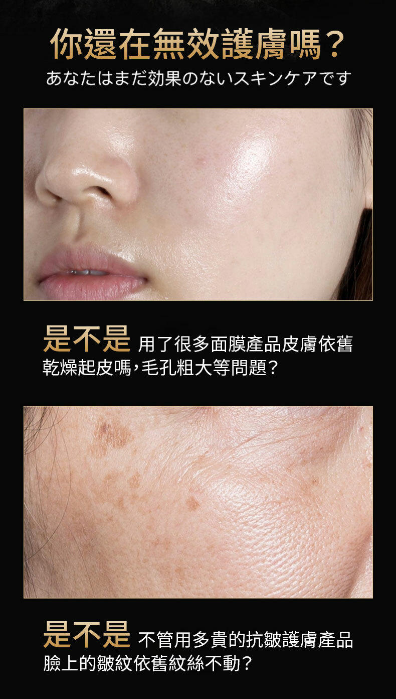 UZUPRO,美白面膜,透明質酸,膠原蛋白,羊胎素,蘋果幹細胞,GDF逆齡因子,NMN,維他命B,維他命C,VC,黑色素,淡斑,美白,去黃,抗氧化,抗衰老,皺紋,提亮,保濕,感敏,日本面膜,蠶絲蛋白,美白針,毛孔,肌膚,UZU Pro,NMN 面膜,韓國面膜,美白針