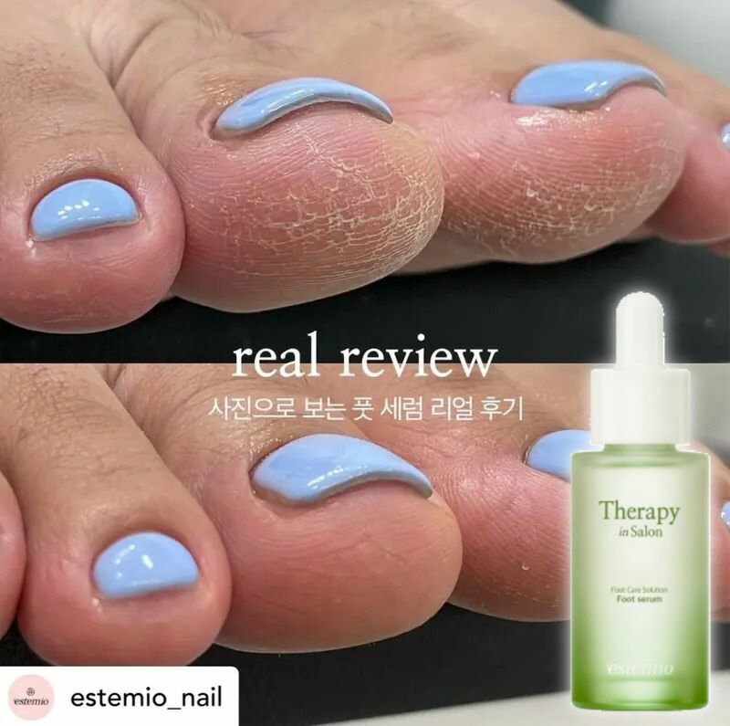 腳仔精華 Estemio Foot serum