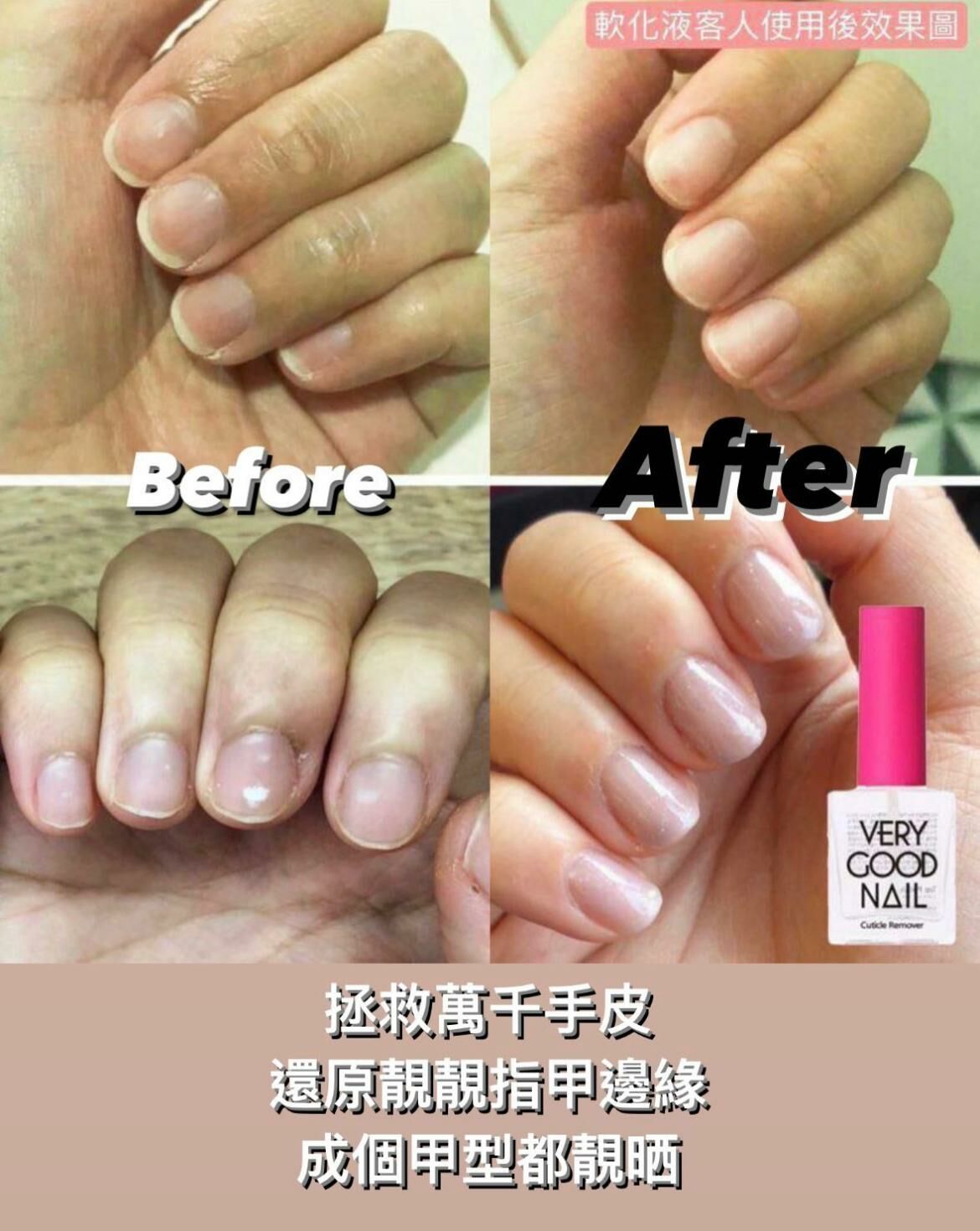 Verygoodnail 死皮軟化液 Cuticle Remover 10ml